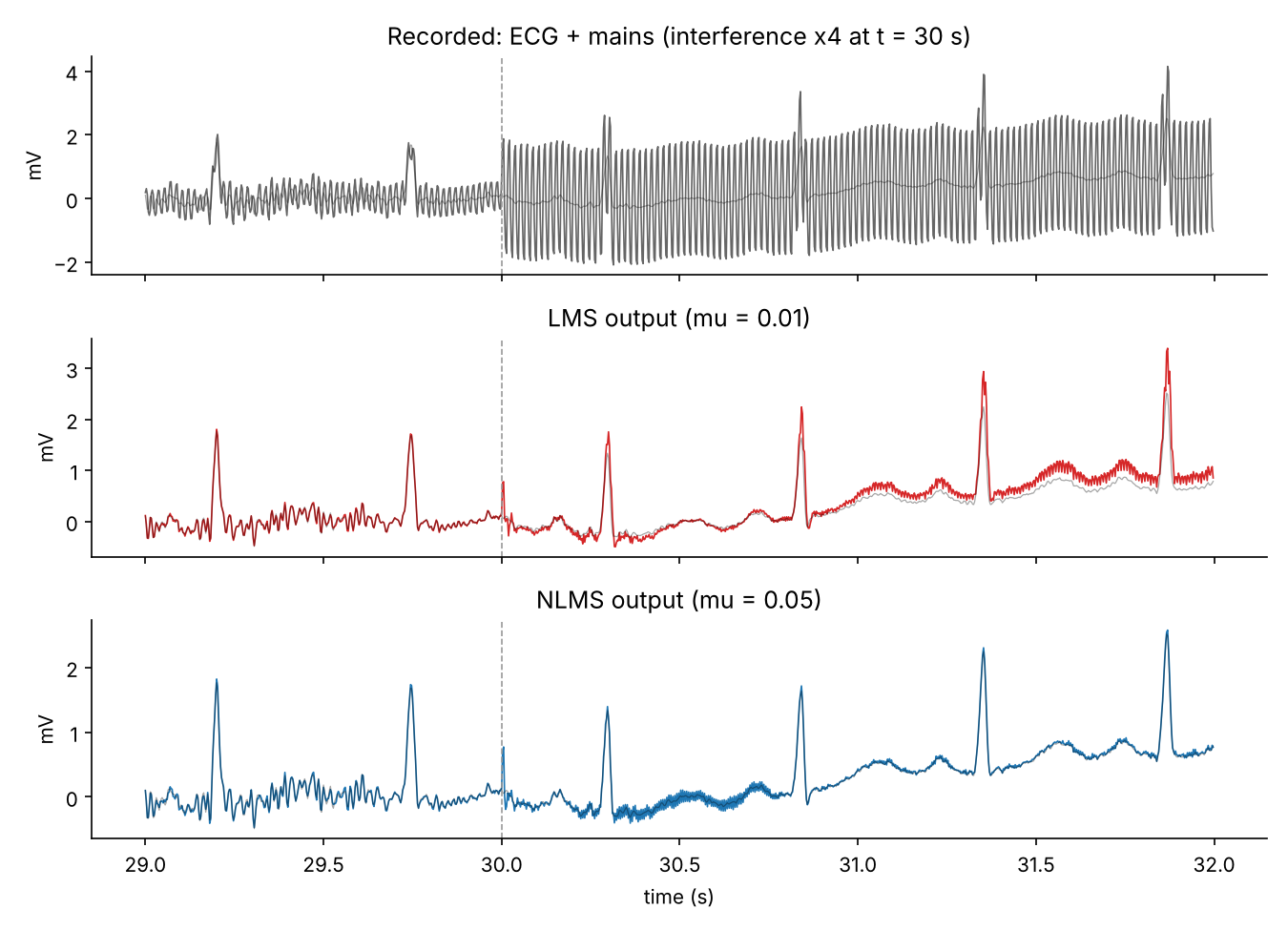 The recorded signal and both outputs around the jump; the clean ECG is drawn in grey underneath